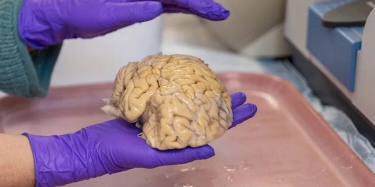 El cerebro de los ‘superancianos’ ofrece algunas claves de la eterna juventud