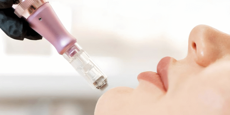 La revolución en el cuidado de la piel: Derma Pen, el secreto para una piel radiante