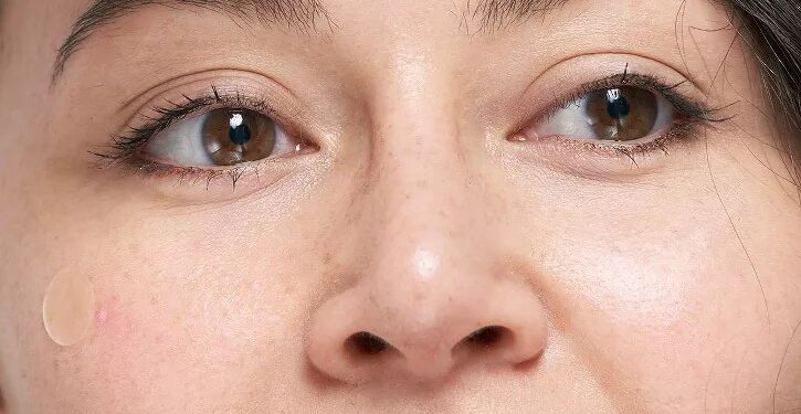 Hero Patch invita a amarte sin filtros