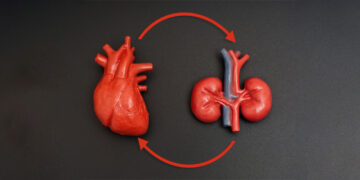 Evidencia internacional redefine el manejo cardiorrenal: México observa un cambio de paradigma clínico