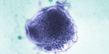 Secretaría de Salud advierte por sarampión: los siete estados que concentran el 85% de los casos en México