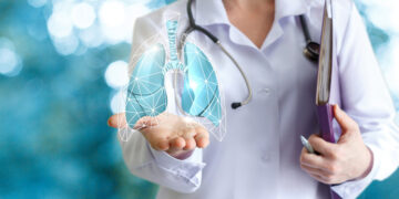 Combinación terapéutica libre de quimioterapia redefine el tratamiento del cáncer de pulmón