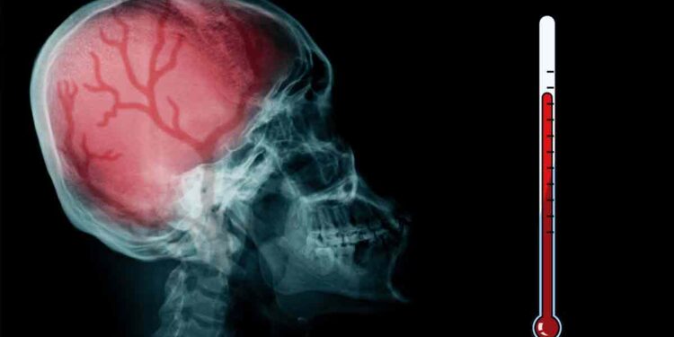 Brote “sin precedentes” de meningitis afecta a Reino Unido, reportan dos muertos