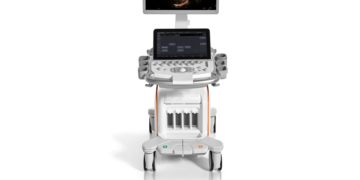 El hígado graso avanza sin síntomas en millones de personas, pero nuevas herramientas permiten detectarlo antes de que sea irreversible