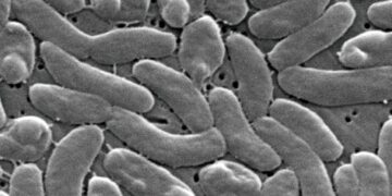 Alertan por la presencia de una bacteria carnívora en costas de Louisiana; aumentan los casos