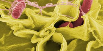 ¿Salmonella u otra infección? Por qué un diagnóstico rápido puede marcar la diferencia